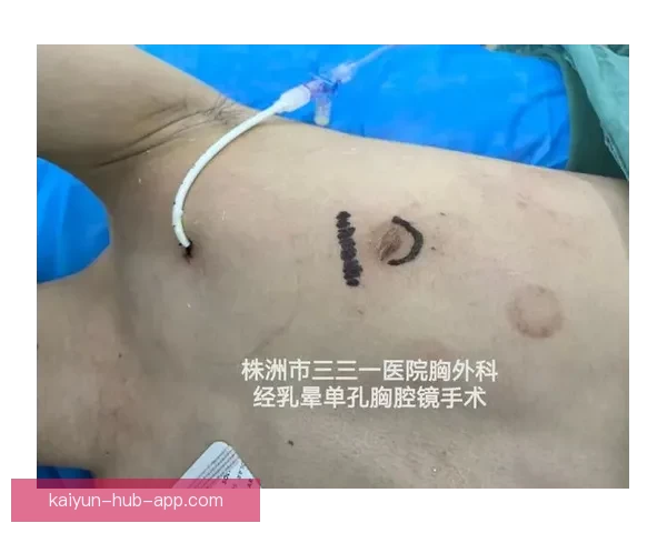 坎宁安气胸康复持续推进 活塞计划一周后复查评估